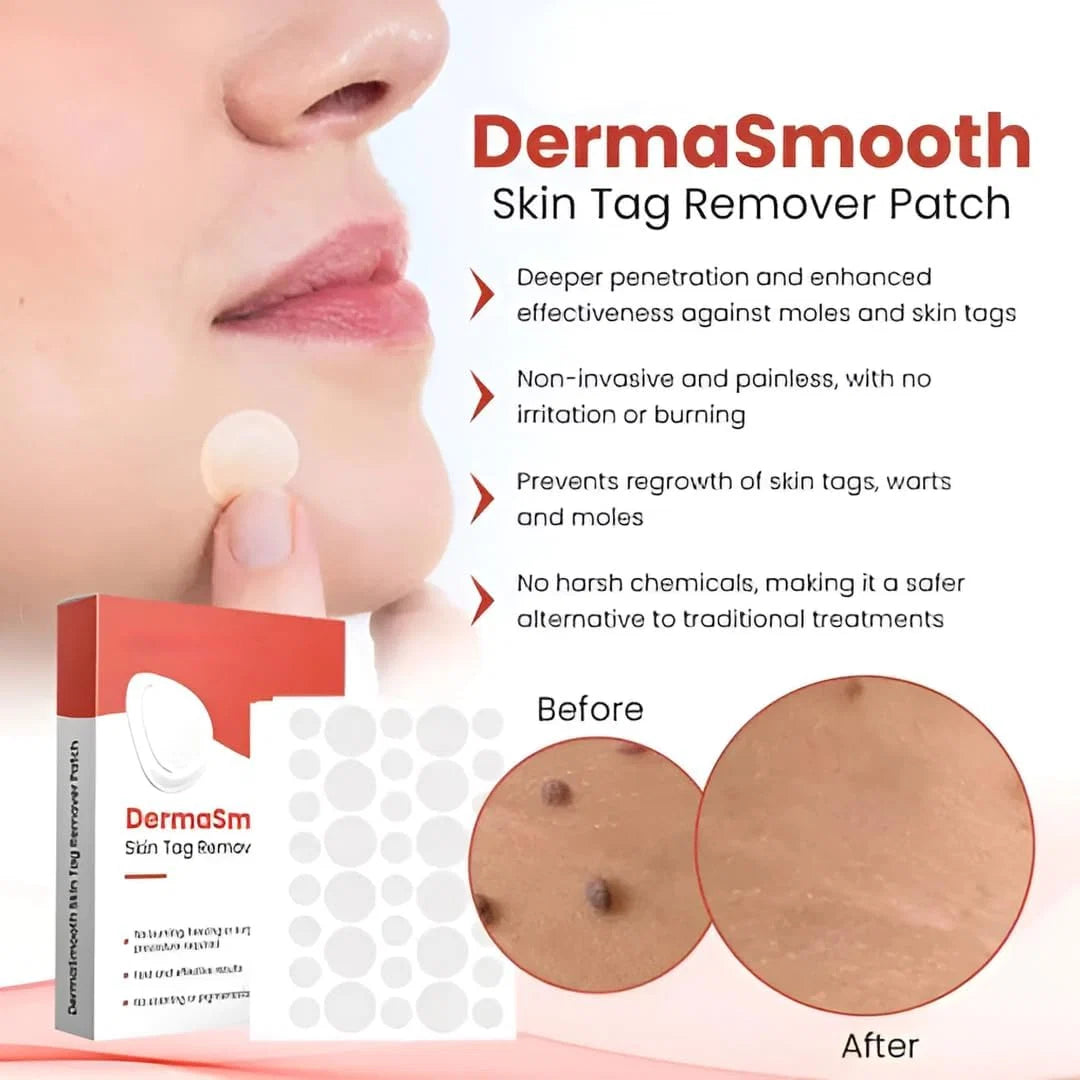 Skin Tag Remover Patch (72 Patches)