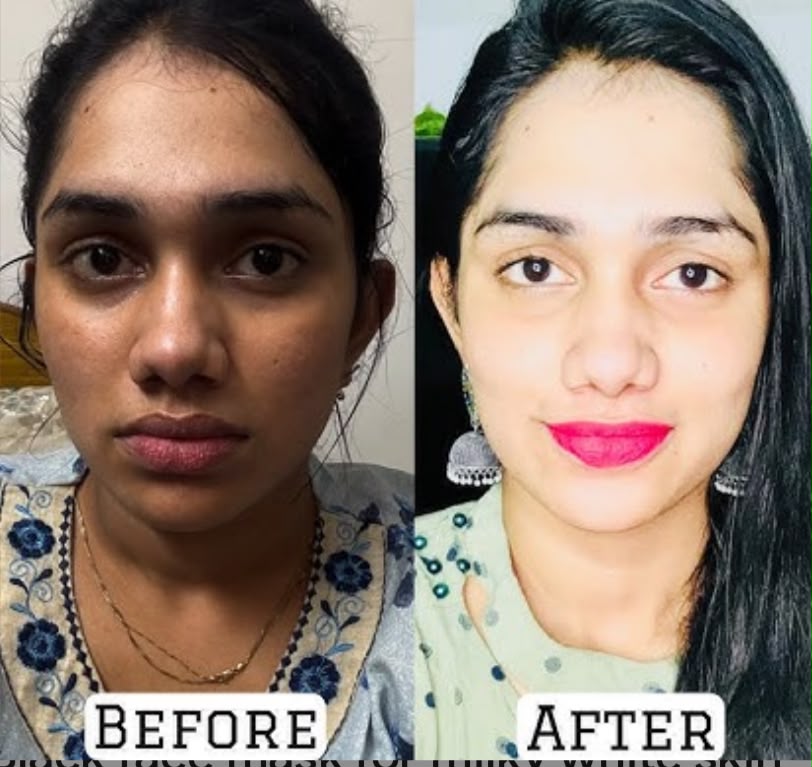 whitening Cream Vitamin C 100% Result