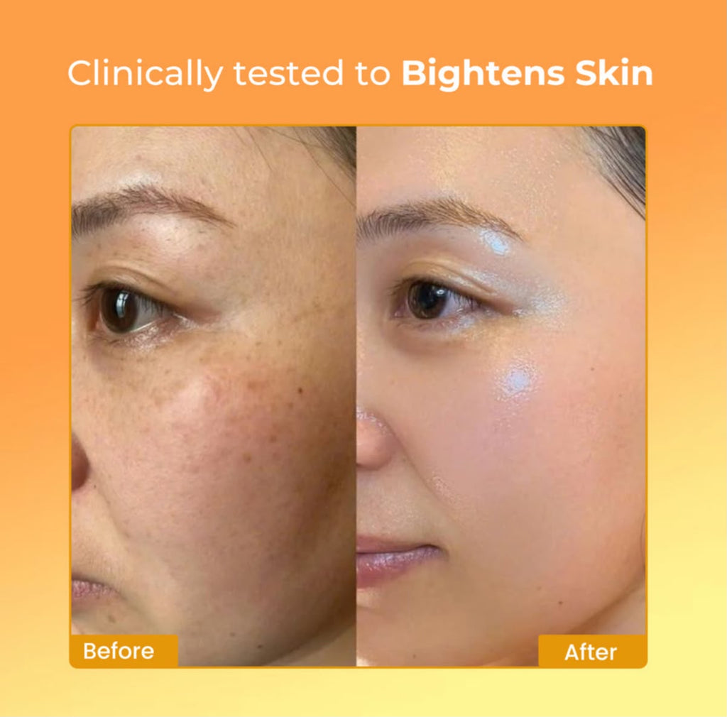 whitening Cream Vitamin C 100% Result